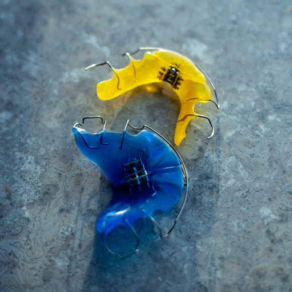 Apereyler (Çene Genişletme)