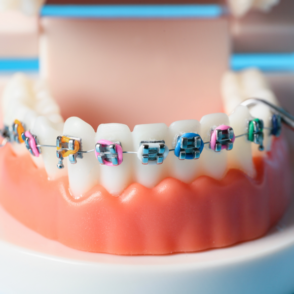 Ortognatik ortodonti