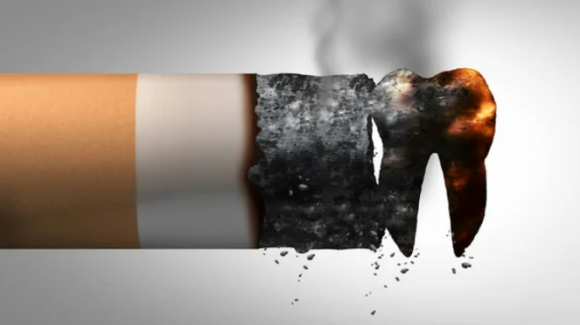 Sigara ve Diş Sağlığı İlişkisi